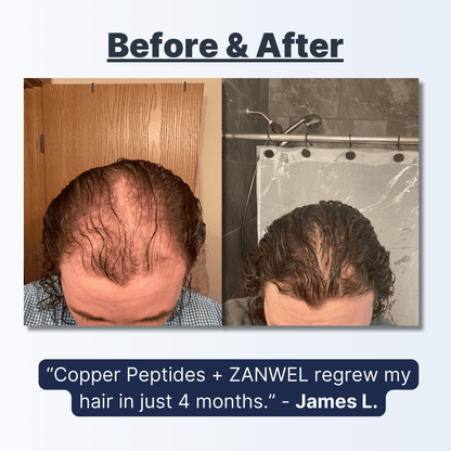 Premium Copper Peptide — Regrow Your Hair Back In 5 Months (or Less)